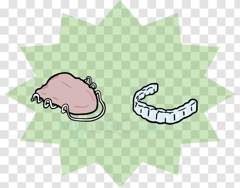 Retainer Dental Braces Clear Aligners Tooth Orthodontics - Tree - Cartoon Transparent PNG