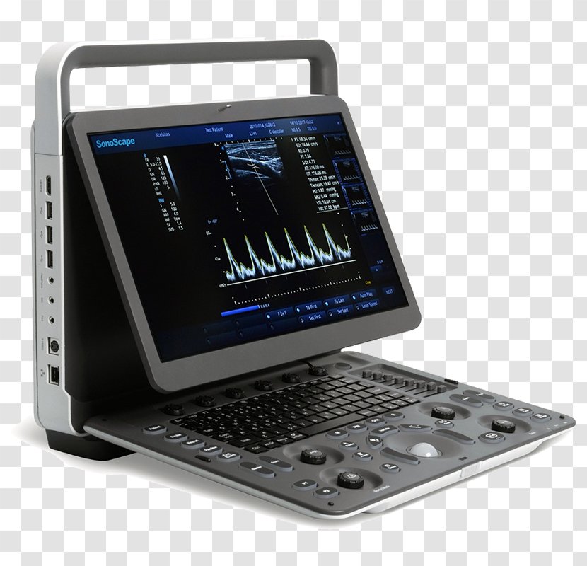 Ultrasonography Portable Ultrasound SonoScape Medical Corp Imaging - Computer Hardware - Ti83 Series Transparent PNG
