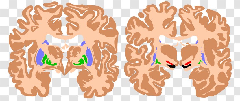 Brain Basal Ganglia Agy Substantia Nigra Ganglion - Frame Transparent PNG