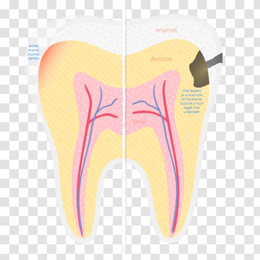 Sports & Energy Drinks Human Tooth Decay Dentist - Cartoon - Drink Transparent PNG