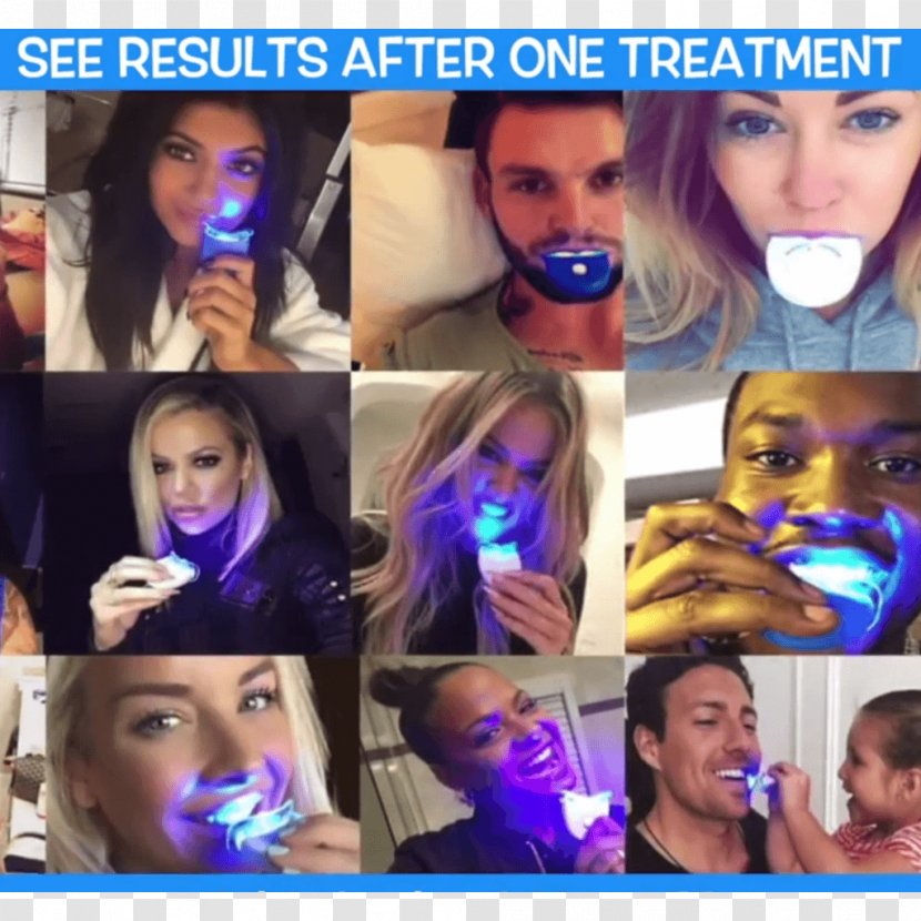 Tooth Whitening Light Dentist Human - Silhouette - Teeth Kit Transparent PNG