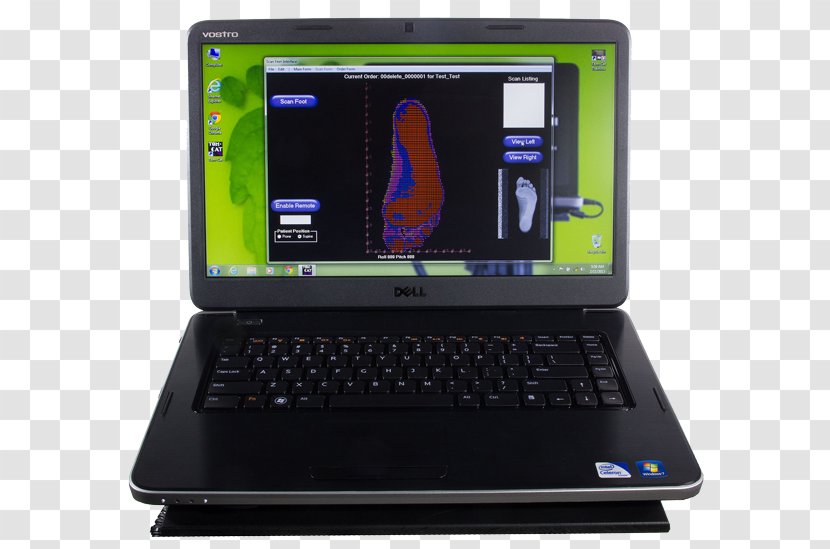 Computer Hardware Image Scanner Netbook Personal Orthotics - Laptop Part - Lab Transparent PNG