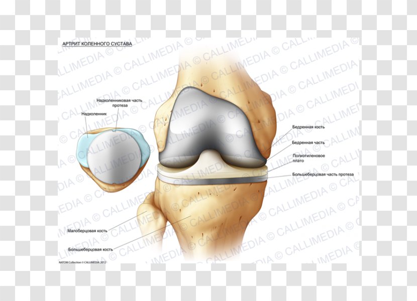 Knee Osteoarthritis Rheumatology Synovial Fluid Prosthesis - Silhouette - Frame Transparent PNG
