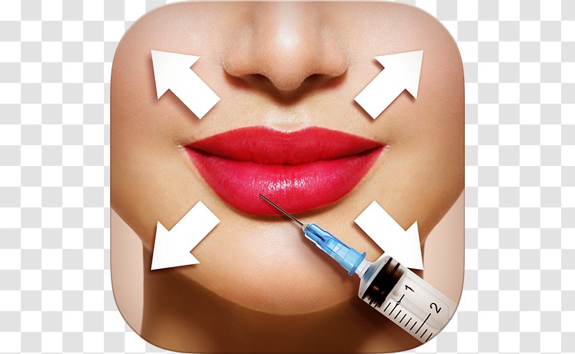 Lip Augmentation Injectable Filler Juvéderm Balm - Cosmetics Transparent PNG