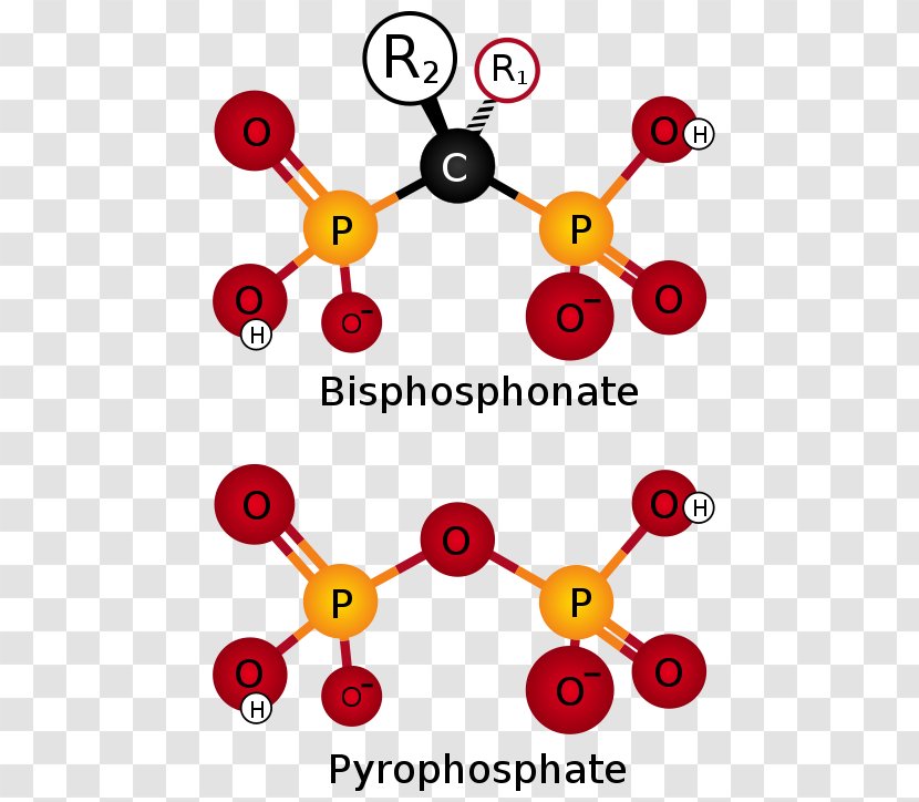 Bisphosphonate Ibandronic Acid Pyrophosphate Pharmaceutical Drug Osteoporosis - Hip Fracture - Artwork Transparent PNG