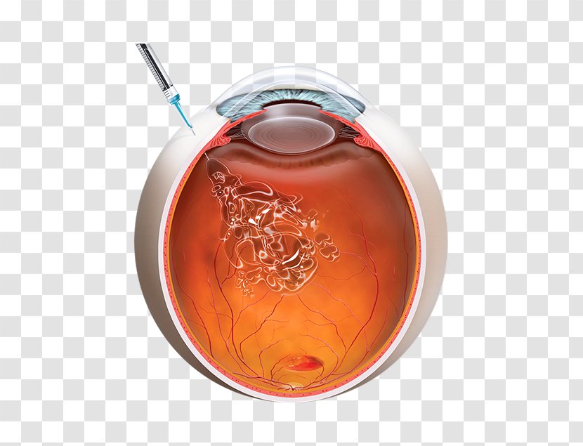 Intravitreal Administration Macular Degeneration Injection Bevacizumab Anti–vascular Endothelial Growth Factor Therapy - Glass - Eye Transparent PNG