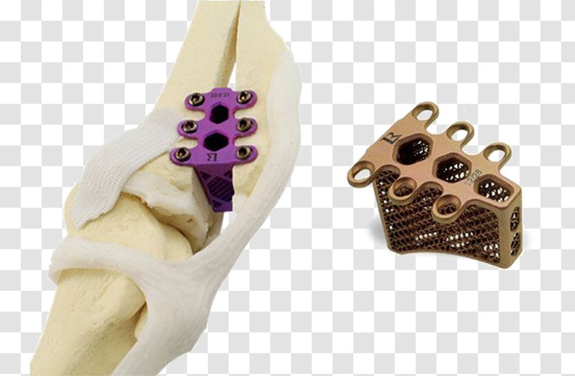 Dog 3D Printing Veterinarian Surgery - 3d Printers - Tooth Transparent PNG