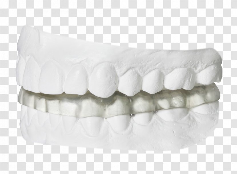 Temporomandibular Joint Dysfunction Splint Dentist Orthodontics - White - Bruxism Transparent PNG