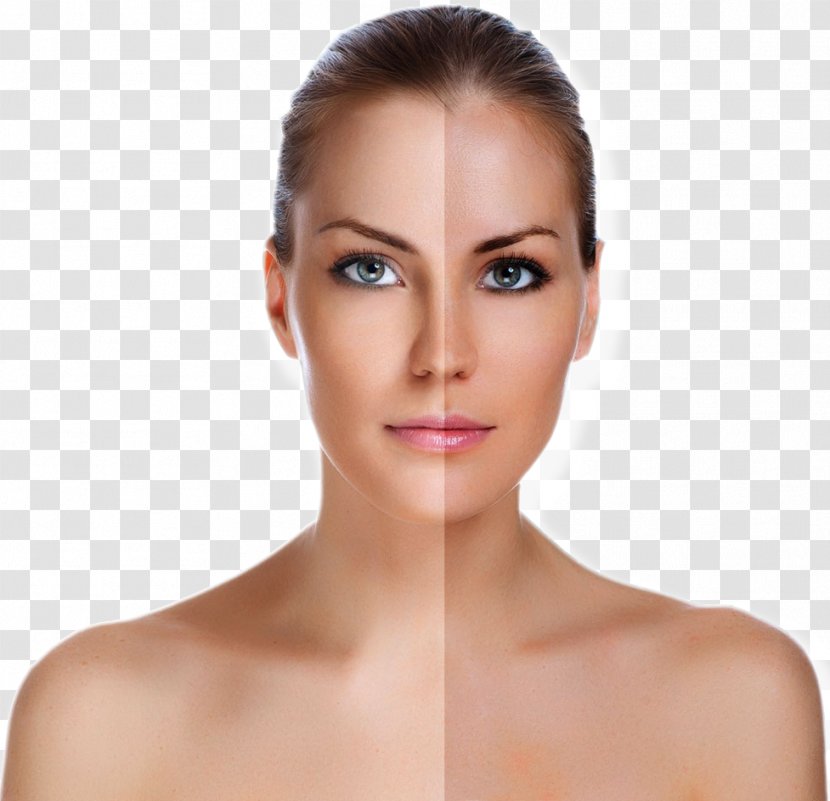 Stock Photography Face Rhytidectomy Skin Transparent PNG