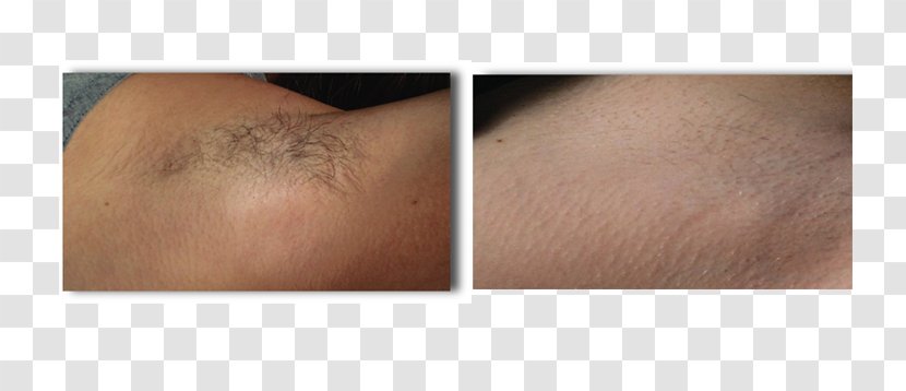 Wrinkle Close-up Shaving FN SCAR Dog Grooming - Eyebrow - Laser Hair Removal Transparent PNG