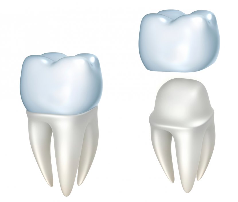 Crown Dentistry Dental Restoration Bridge - Heart - Teeth Transparent PNG