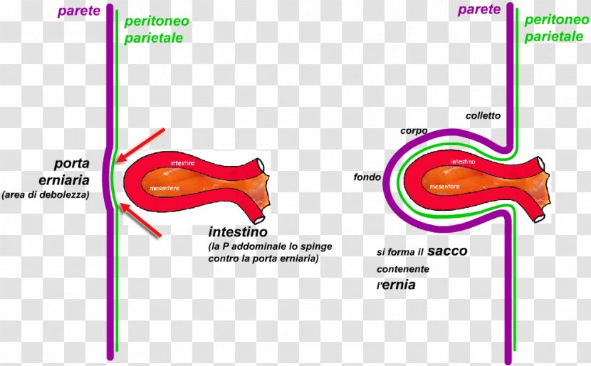 Inguinal Hernia Abdominal Umbilical Schmorl's Nodes - Flower - Osso Transparent PNG