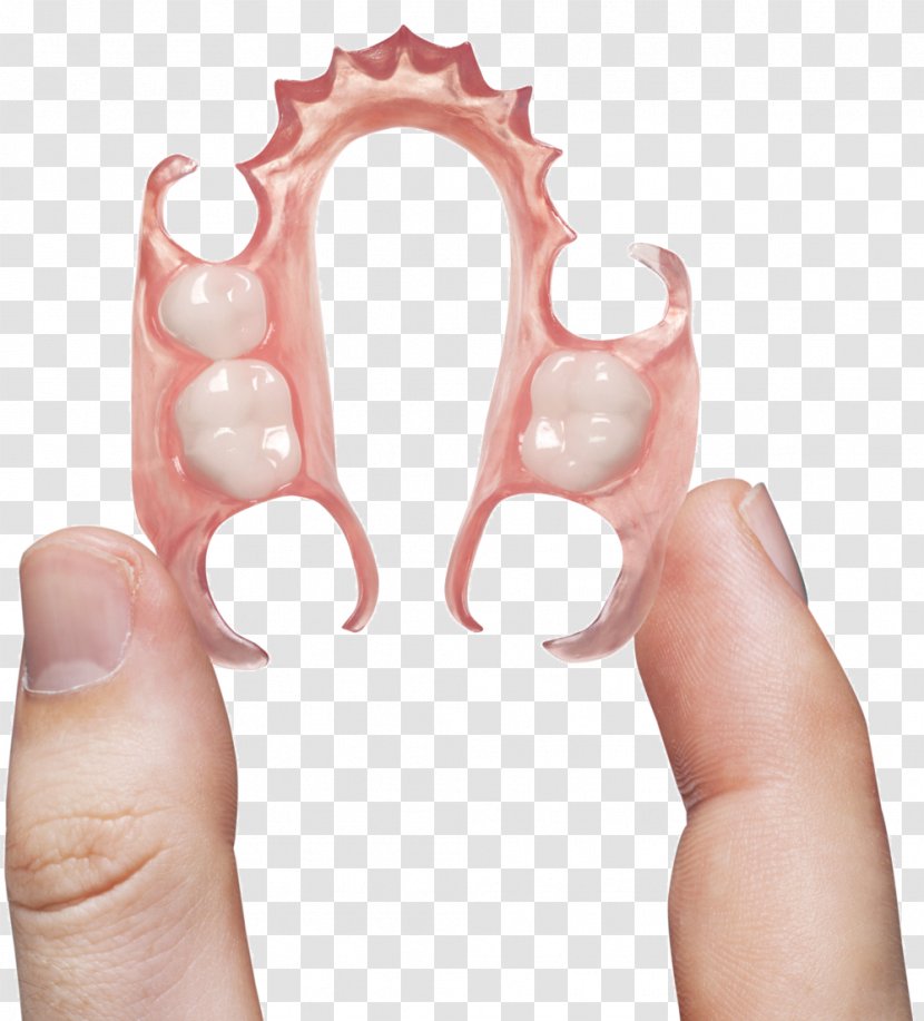 Dental Laboratory Dentures Dentistry Removable Partial Denture - Tooth - Health Care Transparent PNG