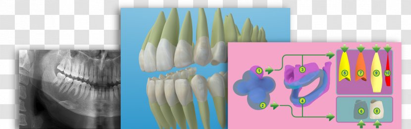 Dental Anatomy Tooth Graphic Design Dentistry - 3d Treatment For Toothache Transparent PNG