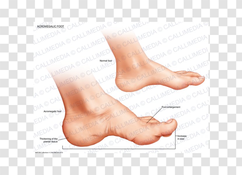 Thumb Acromegaly Foot Ankle Endocrinology - Heart - Nose Transparent PNG