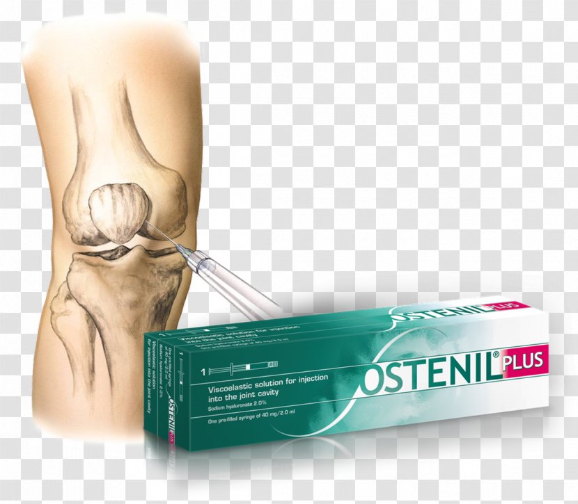 Hyaluronic Acid Osteoarthritis Therapy Joint Injection - Physical - Orthopaedics Transparent PNG