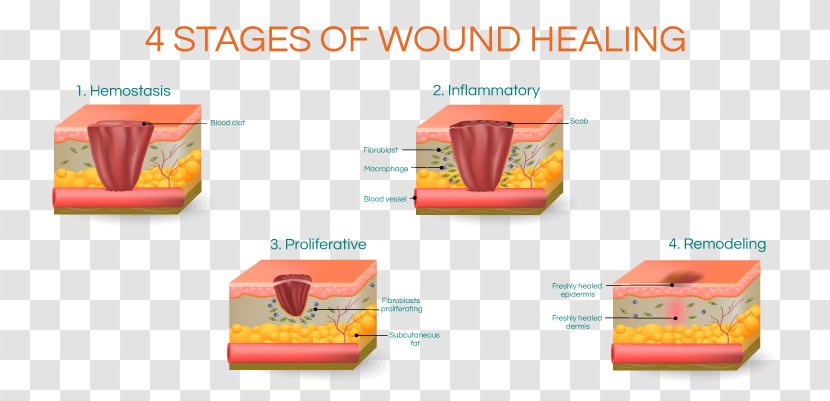 Wound Healing Scar Surgery - Brand Transparent PNG