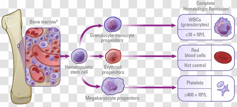 Myelofibrosis Polycythemia Vera Ruxolitinib Multiple Myeloma Hydroxycarbamide - Tree - Frame Transparent PNG