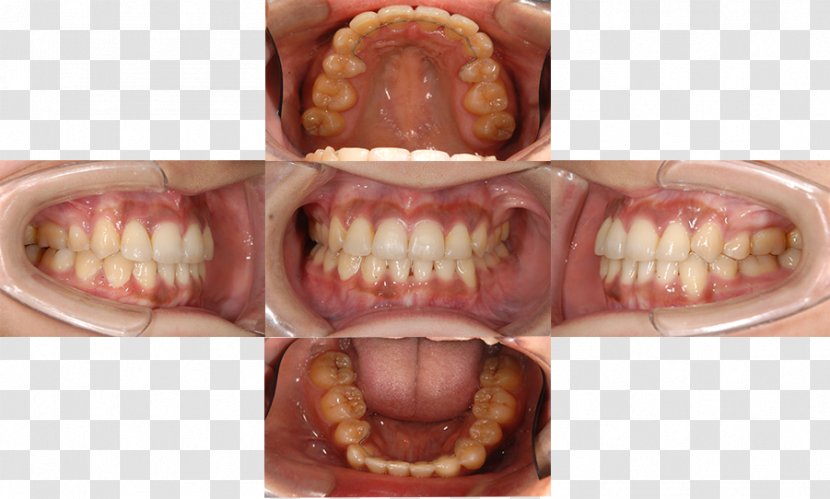 Tooth Periodontal Disease Dentistry Medical Specialist 日本歯周病学会認定歯周病専門医 - Finger - Orthodontic Correction Transparent PNG