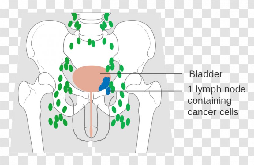 Bladder Cancer Urinary Staging Carcinoma - Flower - Frame Transparent PNG