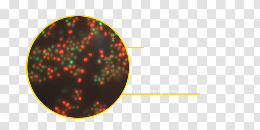 Mannitol Salt Agar Staphylococcus Aureus Epidermidis Plate Halophile - Gramnegative Bacteria - Course Transparent PNG