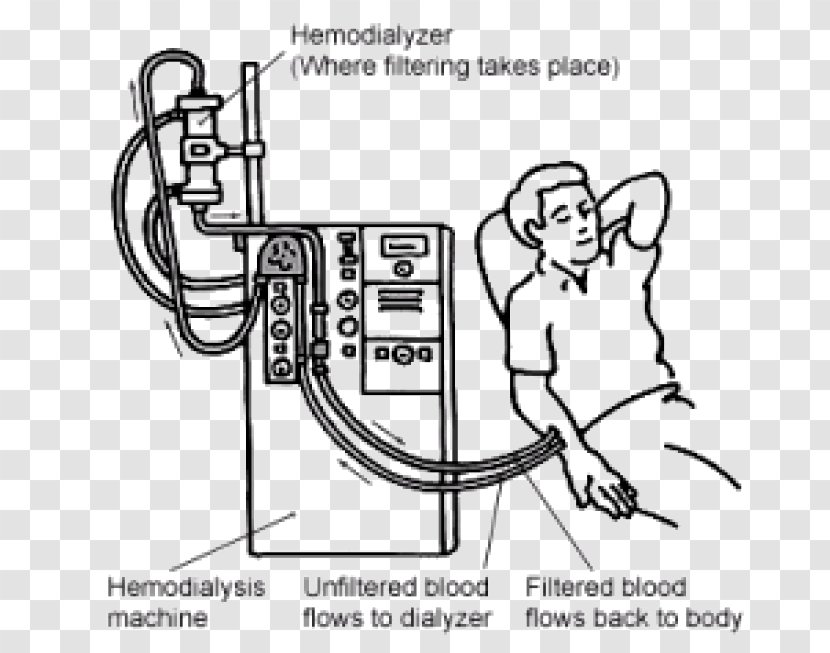 Hemodialysis Kidney Failure Chronic Disease - Watercolor - Excretory System Transparent PNG