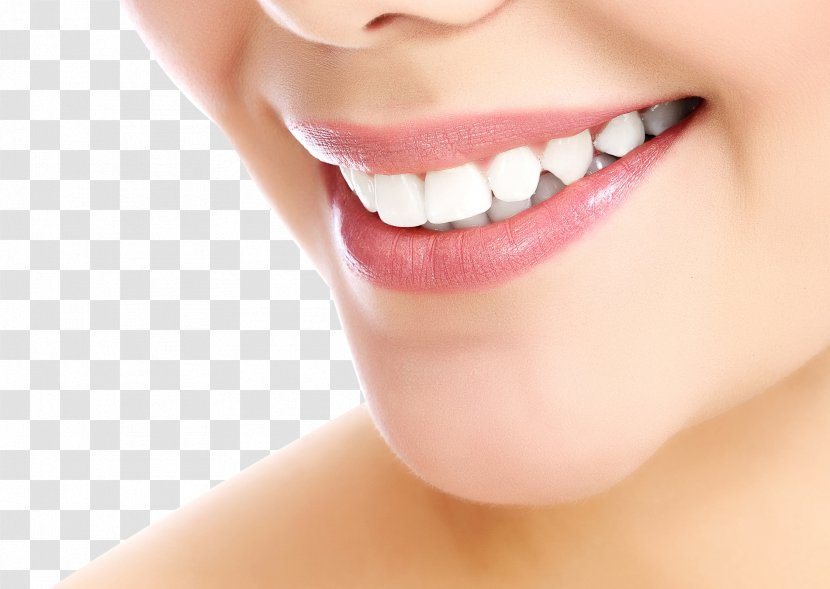 Cosmetic Dentistry Smile Tooth Whitening - Oral Hygiene - US-tooth Side Transparent PNG