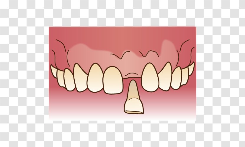審美歯科 Dentist Dentures Dental Technician - Watercolor - Bridge Transparent PNG