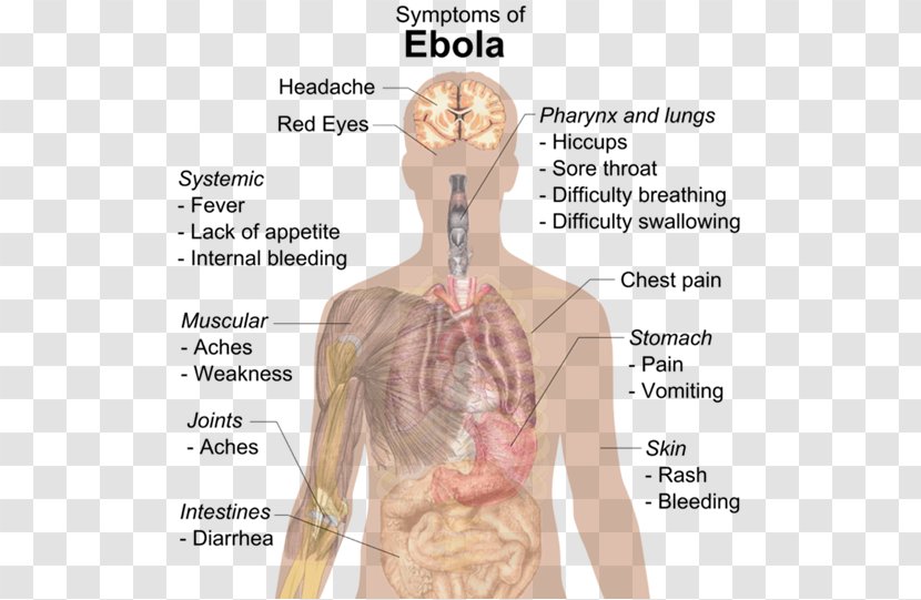 Community-acquired Pneumonia Symptom Viral Infection - Tree - Vomit Transparent PNG