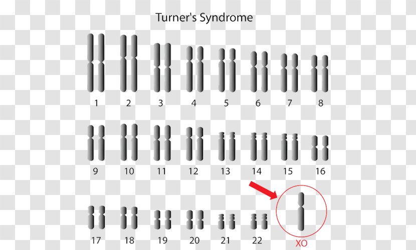 Monosomy Turner Syndrome X Chromosome Triple - Rectangle - Edwards Transparent PNG