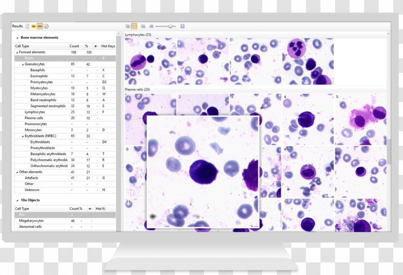 Bone Marrow Laboratory Neutrophil Analysis Corn Wet-milling - Brand Transparent PNG