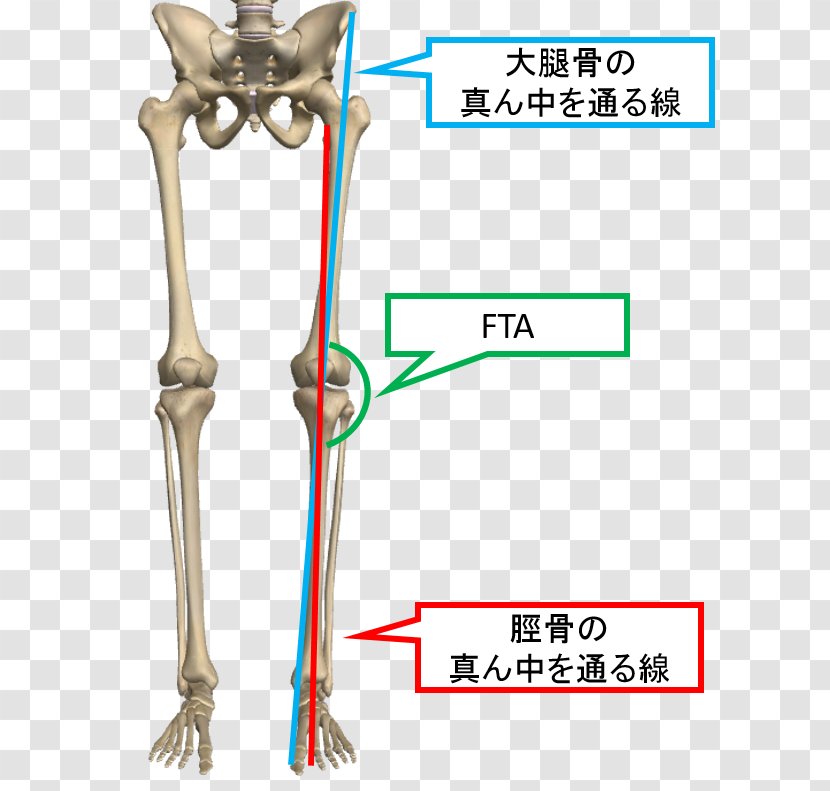 Knee Osteoarthritis Genu Valgum 膝関節 Bone - Frame - Fta Transparent PNG