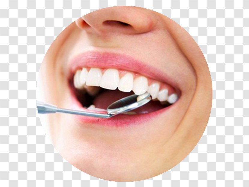 Dentistry Dental Implant Tooth Decay - Surgery - Gums Transparent PNG
