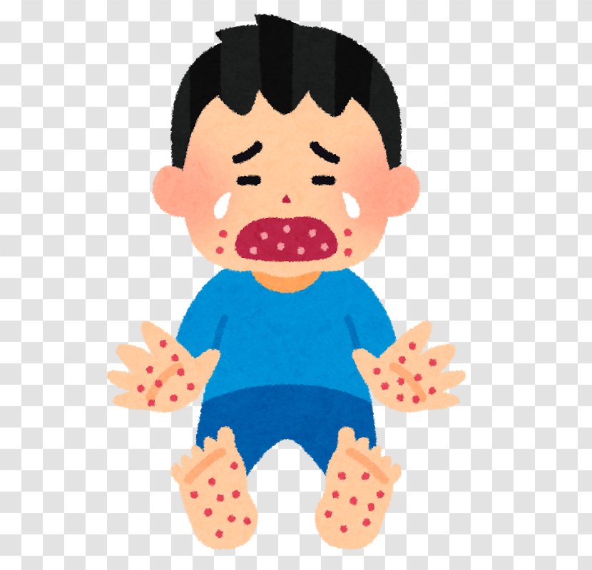 Hand, Foot, And Mouth Disease Infection Adenoviral Keratoconjunctivitis Blister - Chickenpox - Child Transparent PNG