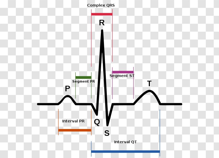 Sinus Rhythm Electrocardiography Heart Rate Tachycardia - Text Transparent PNG