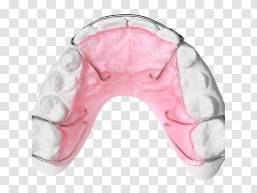 Retainer Orthodontics Orthodontic Technology Jaw Bionator - Neck - Pink Transparent PNG