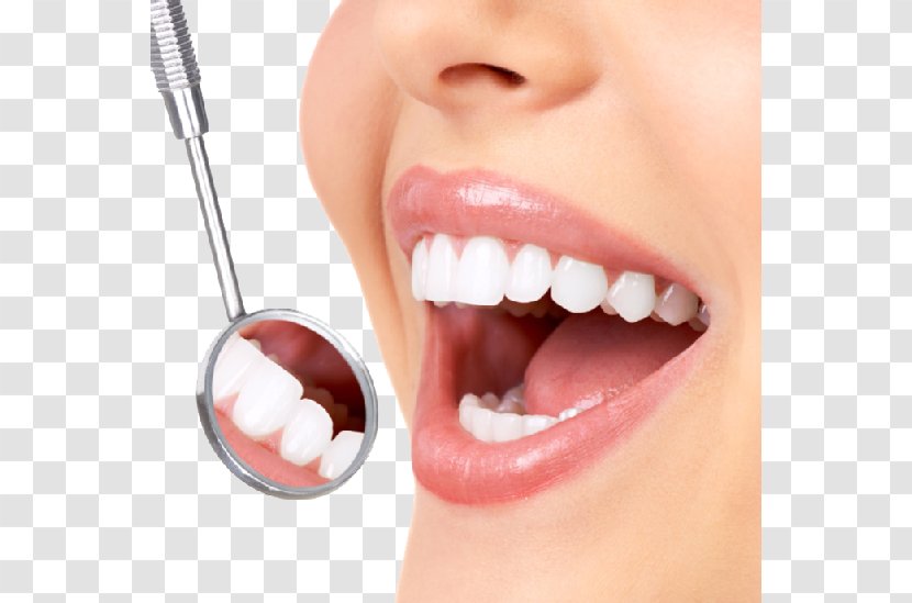 Dentistry Tooth Whitening Human Crown - Decay - Dentist Smile Transparent Background Transparent PNG