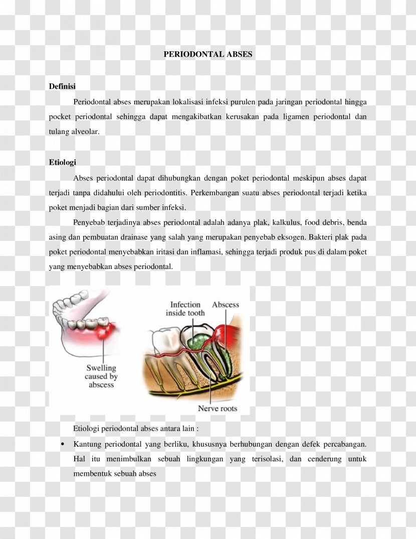 Paper Dental Abscess Font - Diagram - Design Transparent PNG
