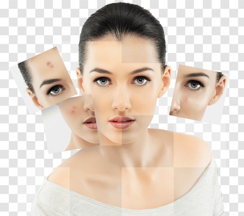 Skin Care Photorejuvenation Human Acne Collagen Induction Therapy - Forehead - Beauty Salon Propaganda Transparent PNG