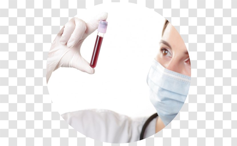 Medicine Anisocytosis Blood Test Complete Count - Infarction Transparent PNG