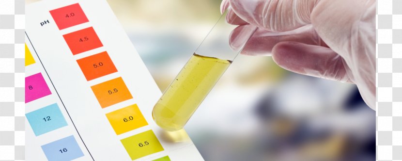 Water Chemistry Science Acid–base Reaction Immunoglobulin M - Neutralization Transparent PNG