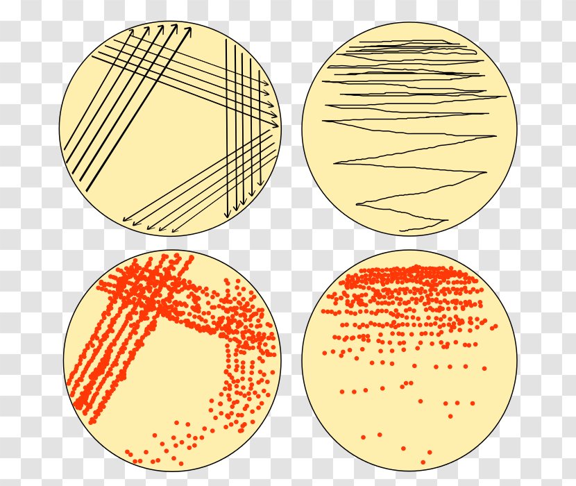 Streaking Microbiology Microbiological Culture Microorganism Bacteria - Yersinia On Macconkey Agar Transparent PNG
