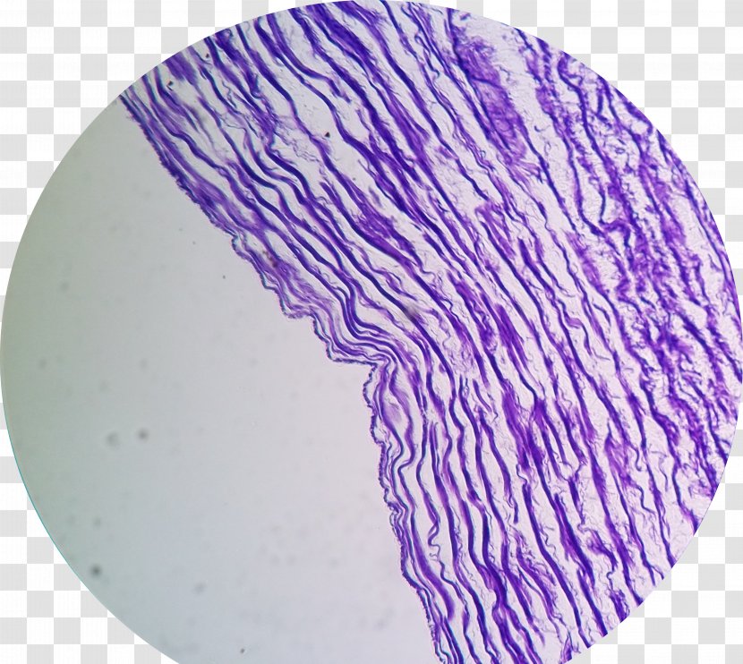 Elastic Fiber Wikimedia Commons Optical Microscope Artery - Verse Transparent PNG