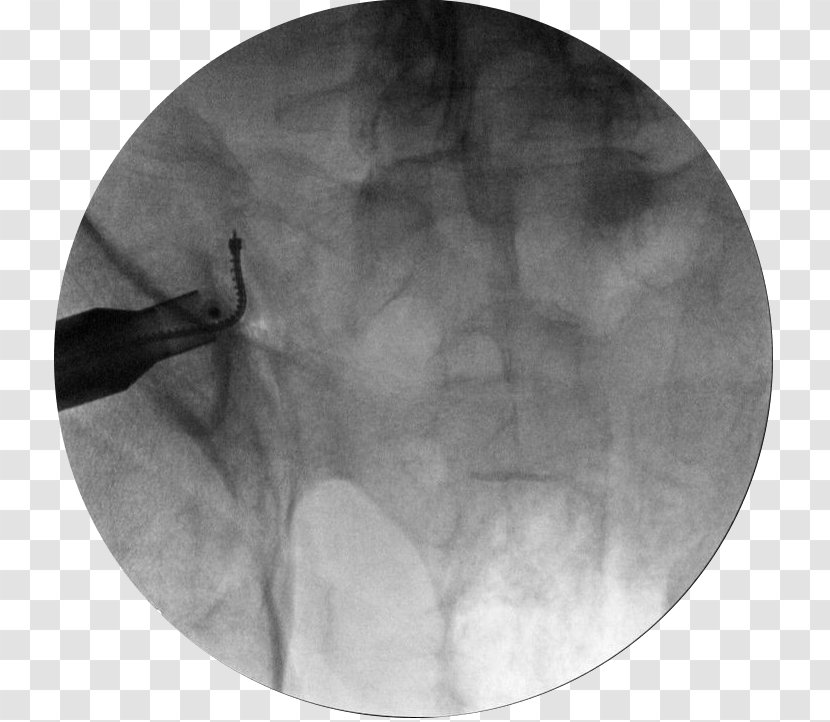 White - Monochrome - Sacroiliac Joint Dysfunction Transparent PNG