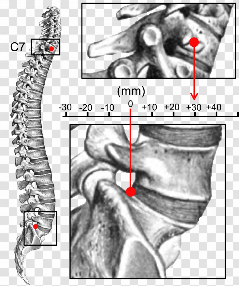 Finger Retrolisthesis Kyphosis Sagittal Plane Vertebral Column - Flower - Spine Transparent PNG