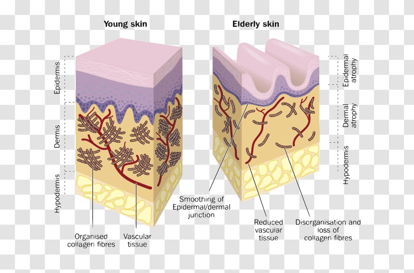 Collagen Skin Wrinkle Hyaluronic Acid Dermis - Old Age - Corporate Elderly Care Transparent PNG