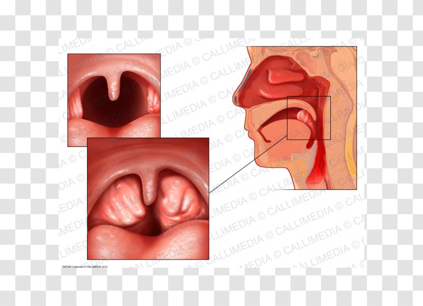 Tonsillitis Anatomy Adenoid Infection - Frame - Tonsil Transparent PNG