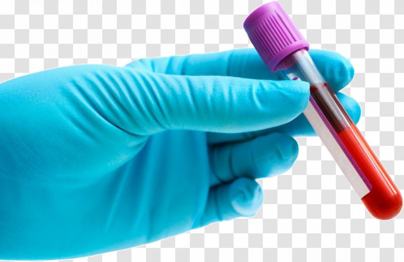 Blood Test Herpes Simplex Virus Labialis Herpetic Whitlow - Disease - Mycoplasma Transparent PNG