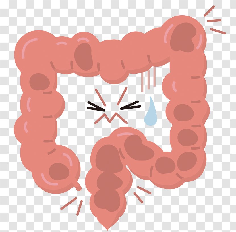 Large Intestine Irritable Bowel Syndrome Constipation Health Diarrhea - Aonori Colon Transparent PNG