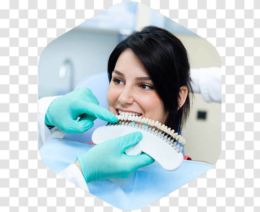 Tooth Whitening Dentist Human Dental Restoration - Smile - Dentistry Transparent PNG